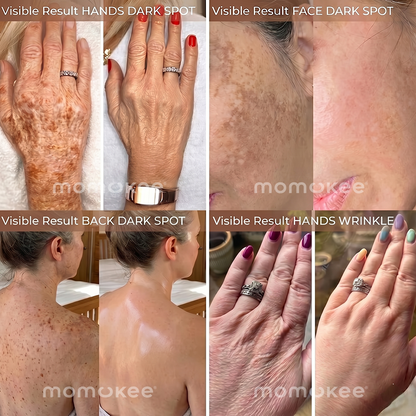 Trilumia® Retinol Firming & Whitening Body Lotion