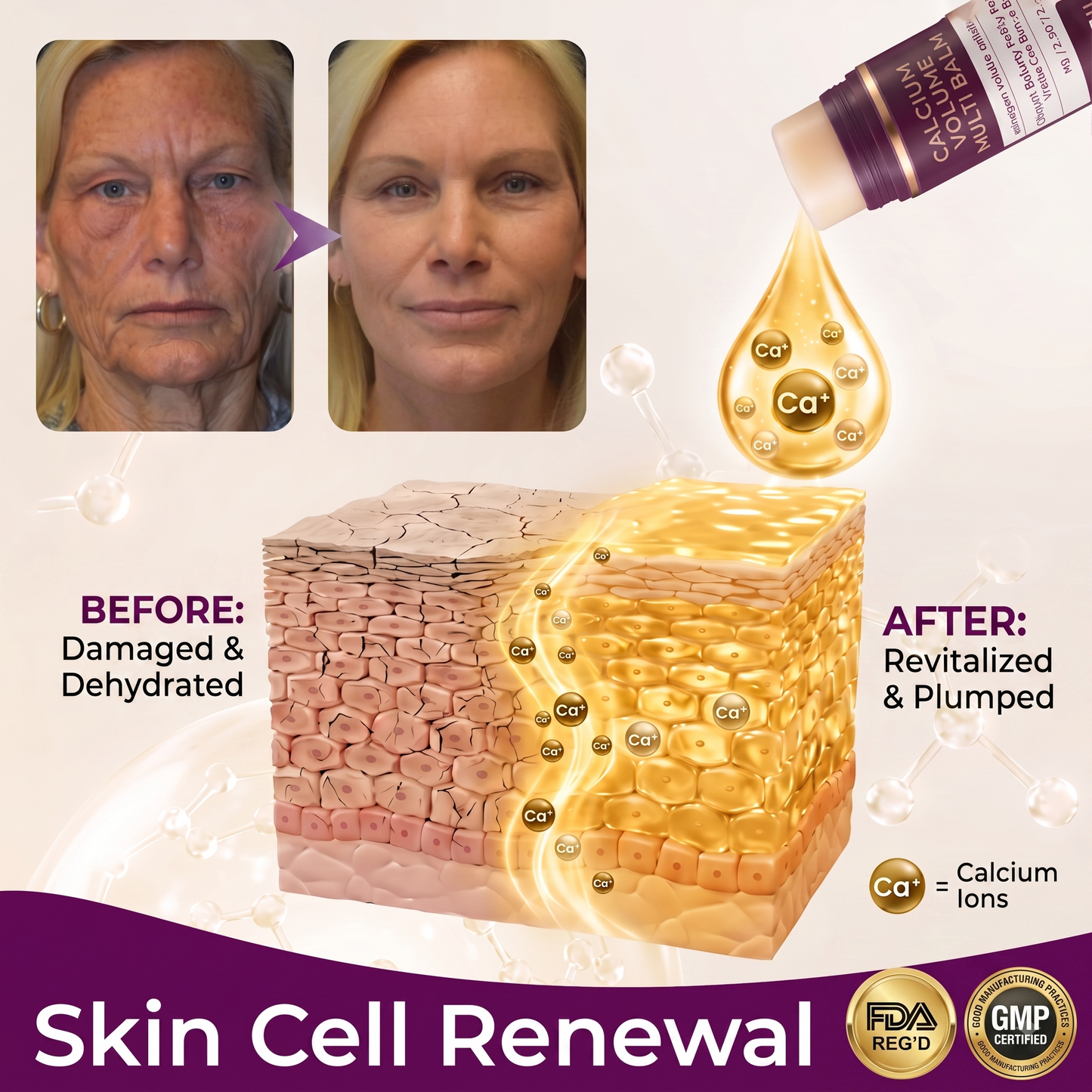 Hudros® Calcium Volume Botox Balm (KRHU)