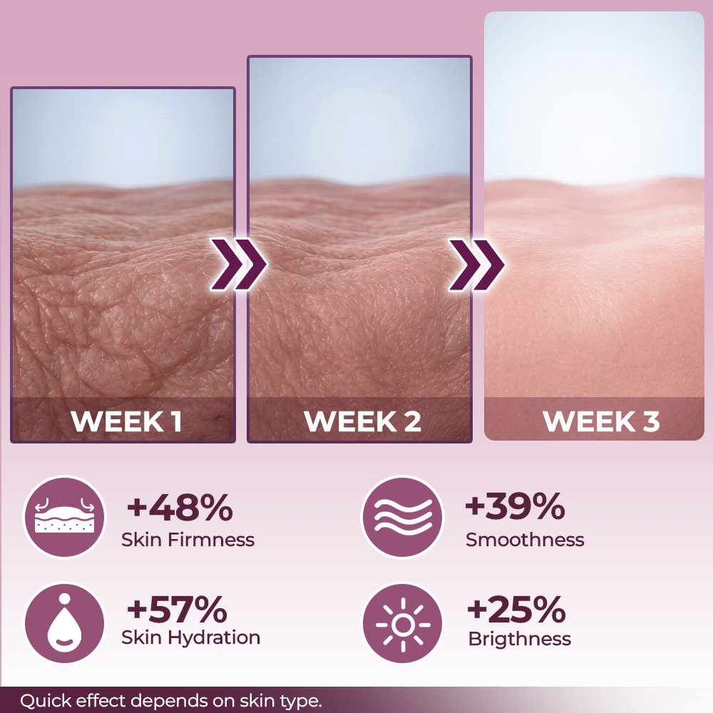 Hudros® Calcium Volume Botox Balm-ai2