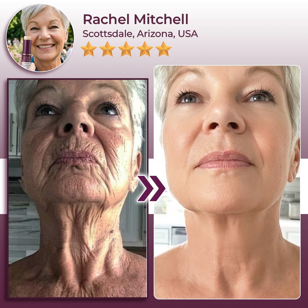 Hudros® Calcium Volume Botox Balm (KRHIA)