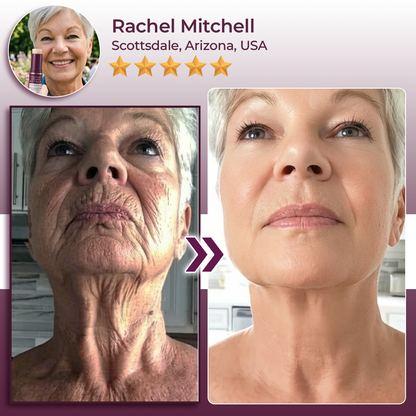 Hudros® Calcium Volume Botox Balm (KRHIA)
