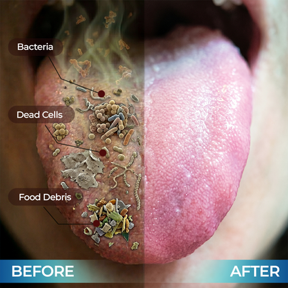 Trilumia® Tongue Cleaning Gel Kit